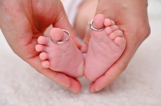 五指山孕妇怎样预防妊娠纹